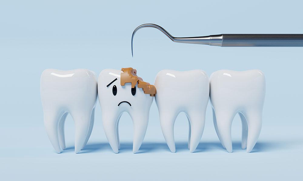 Understanding Cavities: Why Regular Dental Visits Are Crucial